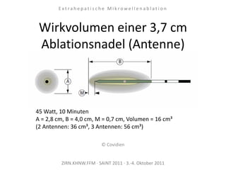 Wirkvolumen einer 3,7 cm
Ablationsnadel (Antenne)
45 Watt, 10 Minuten
A = 2,8 cm, B = 4,0 cm, M = 0,7 cm, Volumen = 16 cm³
(2 Antennen: 36 cm³, 3 Antennen: 56 cm³)
ZIRN.KHNW.FFM · SAINT 2011 · 3.-4. Oktober 2011
E x t r a h e p a t i s c h e M i k r o w e l l e n a b l a t i o n
© Covidien
 