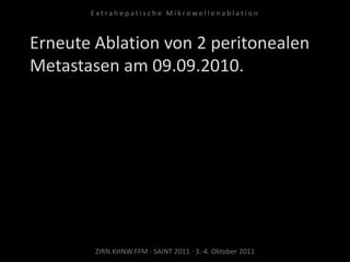Erneute Ablation von 2 peritonealen
Metastasen am 09.09.2010.
ZIRN.KHNW.FFM · SAINT 2011 · 3.-4. Oktober 2011
E x t r a h e p a t i s c h e M i k r o w e l l e n a b l a t i o n
 
