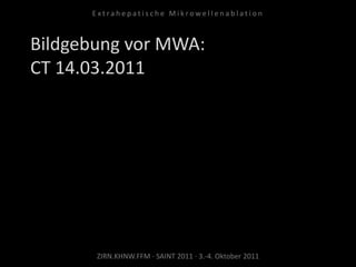 Bildgebung vor MWA:
CT 14.03.2011
ZIRN.KHNW.FFM · SAINT 2011 · 3.-4. Oktober 2011
E x t r a h e p a t i s c h e M i k r o w e l l e n a b l a t i o n
 