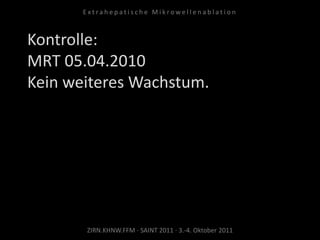 Kontrolle:
MRT 05.04.2010
Kein weiteres Wachstum.
ZIRN.KHNW.FFM · SAINT 2011 · 3.-4. Oktober 2011
E x t r a h e p a t i s c h e M i k r o w e l l e n a b l a t i o n
 