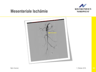 Björn Gemein 1011. Oktober 2016
Mesenteriale Ischämie
 