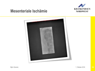 Björn Gemein 1021. Oktober 2016
Mesenteriale Ischämie
 