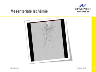 Björn Gemein 1071. Oktober 2016
Mesenteriale Ischämie
 