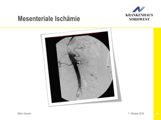 Björn Gemein 401. Oktober 2016
Mesenteriale Ischämie
 