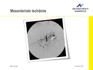 Björn Gemein 421. Oktober 2016
Mesenteriale Ischämie
 