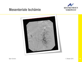 Björn Gemein 561. Oktober 2016
Mesenteriale Ischämie
 