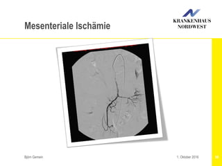 Björn Gemein 581. Oktober 2016
Mesenteriale Ischämie
 