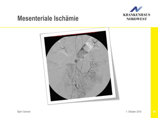 Björn Gemein 661. Oktober 2016
Mesenteriale Ischämie
 