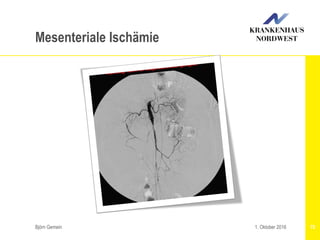 Björn Gemein 701. Oktober 2016
Mesenteriale Ischämie
 