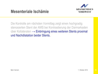 Björn Gemein 76
Mesenteriale Ischämie
Die Kontrolle am nächsten Vormittag zeigt einen hochgradig
stenosierten Stent der AMS bei Kontrastierung der Darmarkaden
über Kollateralen → Einbringung eines weiteren Stents proximal
und Nachdilatation beider Stents.
1. Oktober 2016
 