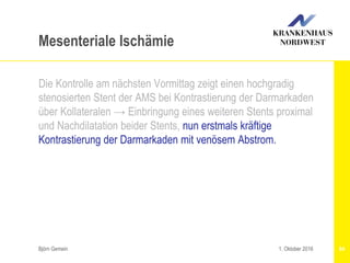Björn Gemein 84
Mesenteriale Ischämie
Die Kontrolle am nächsten Vormittag zeigt einen hochgradig
stenosierten Stent der AMS bei Kontrastierung der Darmarkaden
über Kollateralen → Einbringung eines weiteren Stents proximal
und Nachdilatation beider Stents, nun erstmals kräftige
Kontrastierung der Darmarkaden mit venösem Abstrom.
1. Oktober 2016
 