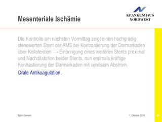 Björn Gemein 86
Mesenteriale Ischämie
Die Kontrolle am nächsten Vormittag zeigt einen hochgradig
stenosierten Stent der AMS bei Kontrastierung der Darmarkaden
über Kollateralen → Einbringung eines weiteren Stents proximal
und Nachdilatation beider Stents, nun erstmals kräftige
Kontrastierung der Darmarkaden mit venösem Abstrom.
Orale Antikoagulation.
1. Oktober 2016
 