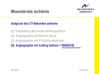Björn Gemein 94
Mesenteriale Ischämie
Aufgrund des CT-Befundes zeitnahe
[1] Umstellung der oralen Antikoagulation
[2] Angiographie mit Stent in Stent
[3] Angiographie mit PTA-Ballonkatheter
[4] Angiographie mit Cutting balloon + DEB/DCB
(Drug eluting/coated balloon)
1. Oktober 2016
 