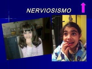 NERVIOSISMONERVIOSISMO
 