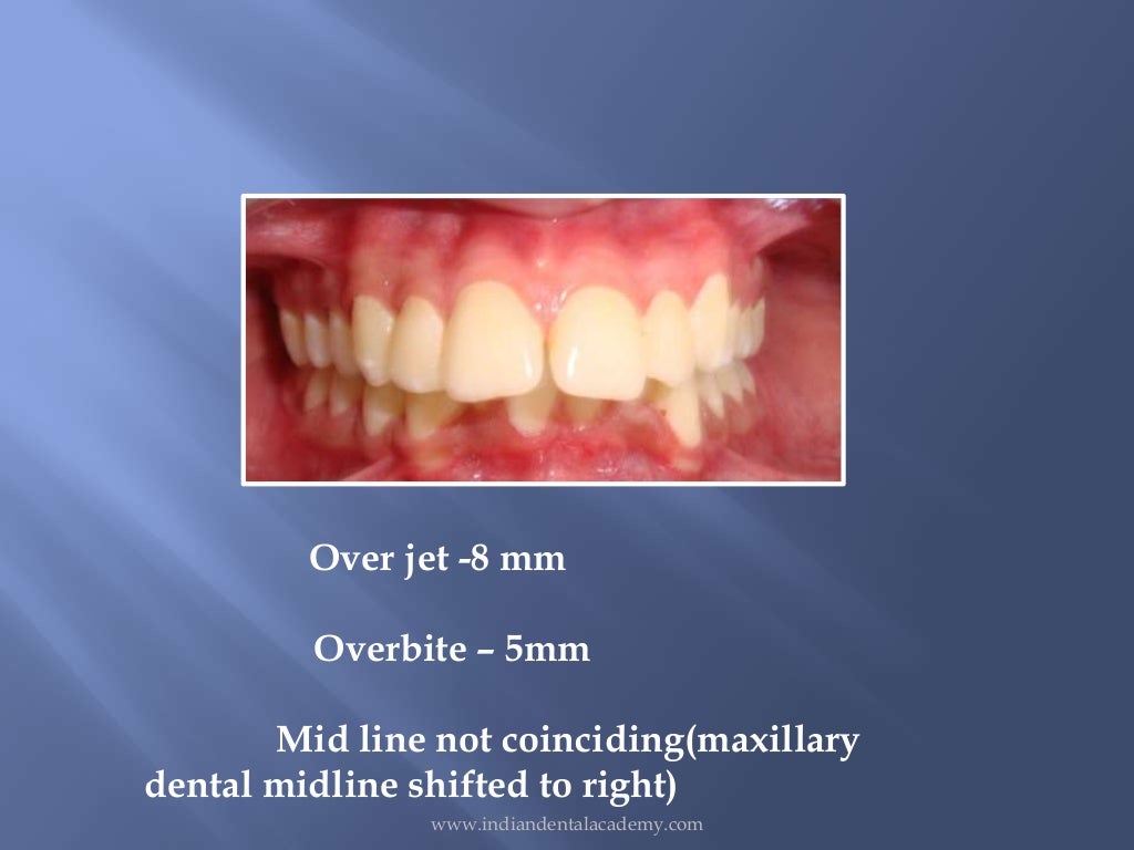 orthodontics patient records preparation /certified fixed orthodontic…