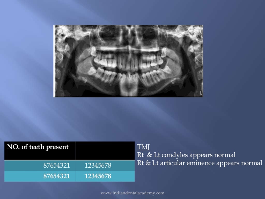 orthodontics patient records preparation /certified fixed orthodontic…