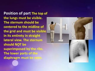 Sternum Radiography Positioning Ppt on chest radiography.pptx