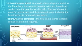 • (b)keratinocytes added: two weeks after collagen is added to
the fibroblasts, the extracted keratinocytes are thawed and
seeded onto the new dermal skin cells. They are allowed to
grow for several days and then exposed to air, including the
keratinocytes to form epidermal layers.
• (c)growth cycle completed : the new skin is stored in sterile
containers until it is required.
 