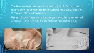 • The first synthetic skin was invented by John F. Burke, chief of
trauma services at Massachusetts General hospital, and Ioannis
V. Yannas, (MIT) in Cambridge.
• Using collagen fibers and a long sugar molecules, they formed
a porous (full of small holes) material resembling skin.
 