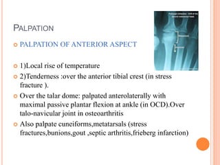 PALPATION
 PALPATION OF ANTERIOR ASPECT
 1)Local rise of temperature
 2)Tenderness :over the anterior tibial crest (in ...