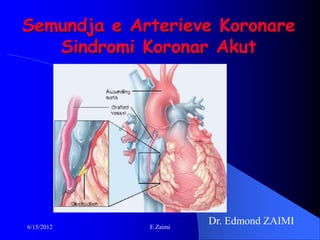 Semundja e Arterieve Koronare
   Sindromi Koronar Akut




6/15/2012    E Zaimi
                       Dr. Edmond ZAIMI
 