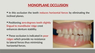Resistant Ridges JVSIHCVASCLJ oucgCFL'JBAOJLBC;DBCP;DC.pptx