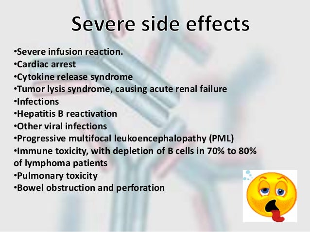 Rituximab Infusion Side Effects