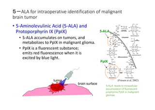 ５－ALAforintraoperativeidentificationofmalignant
braintumor
• 5‐AminolevulinicAcid(5‐ALA)and
Protoporphyrin IX(PpIX)
• 5‐ALAaccumulatesontumors,and
metabolizestoPpIX inmalignantglioma.
• PpIX isafluorescentsubstance;
emitsredfluorescencewhenitis
excitedbybluelight.

tumor

brain surface

5-ALA

PpIX

(Friesen et al, 2002)
5-ALA leads to intracellular
accumulation of fluorescent
prophyrins PpIX in malignant
gliomas

 
