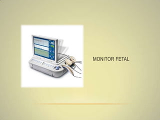 MONITOR FETAL
 