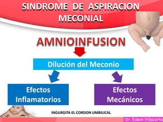 Dr. Edwin Villacorta
Dilución del Meconio
Efectos
Inflamatorios
Efectos
Mecánicos
INGURGITA EL CORDON UMBILICAL
SINDROME DE ASPIRACION
MECONIAL
SINDROME DE ASPIRACION
MECONIAL
 