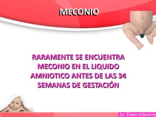 Dr. Edwin Villacorta
MECONIOMECONIO
RARAMENTE SE ENCUENTRA
MECONIO EN EL LIQUIDO
AMNIOTICO ANTES DE LAS 34
SEMANAS DE GESTACIÓN
RARAMENTE SE ENCUENTRA
MECONIO EN EL LIQUIDO
AMNIOTICO ANTES DE LAS 34
SEMANAS DE GESTACIÓN
 