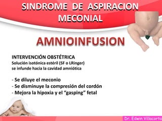 Dr. Edwin Villacorta
SINDROME DE ASPIRACION
MECONIAL
SINDROME DE ASPIRACION
MECONIAL
INTERVENCIÓN OBSTÉTRICA
Solución isotónica estéril (SF o LRinger)
se infunde hacia la cavidad amniótica
- Se diluye el meconio
- Se disminuye la compresión del cordón
- Mejora la hipoxia y el “gasping” fetal
 