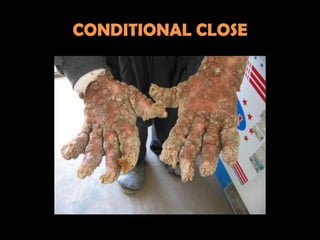 CONDITIONAL CLOSE
 