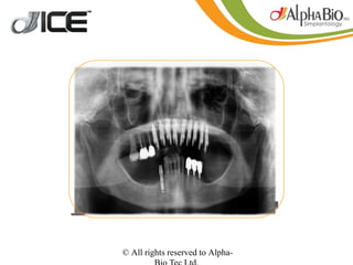 © All rights reserved to Alpha-
 