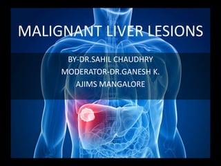 MALIGNANT LIVER LESIONS
BY-DR.SAHIL CHAUDHRY
MODERATOR-DR.GANESH K.
AJIMS MANGALORE
 
