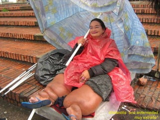 Elefantitis “una enfermedad muy extraña” 