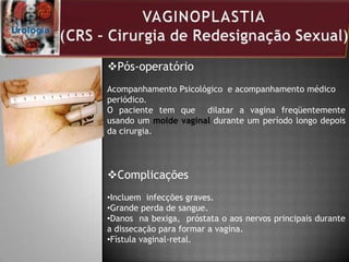 Pós-operatório
Acompanhamento Psicológico e acompanhamento médico
periódico.
O paciente tem que dilatar a vagina freqüentemente
usando um molde vaginal durante um período longo depois
da cirurgia.
Complicações
•Incluem infecções graves.
•Grande perda de sangue.
•Danos na bexiga, próstata o aos nervos principais durante
a dissecação para formar a vagina.
•Fístula vaginal-retal.
 