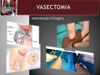 Intervenção Cirúrgica
 