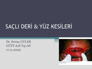 SAÇLI DERİ & YÜZ KESİLERİ

Dr. Sertaç GÜLER
GÜTF Acil Tıp AD
17.11.2009
 