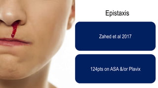 Epistaxis
Zahed et al 2017
124pts on ASA &/or Plavix
 
