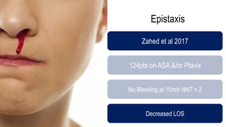 Epistaxis
Zahed et al 2017
124pts on ASA &/or Plavix
No Bleeding at 10min NNT = 2
Decreased LOS
 