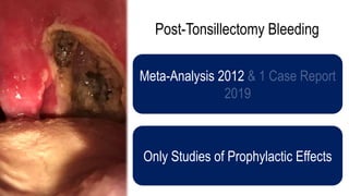 Post-Tonsillectomy Bleeding
Meta-Analysis 2012
Only Studies of Prophylactic Effects
 