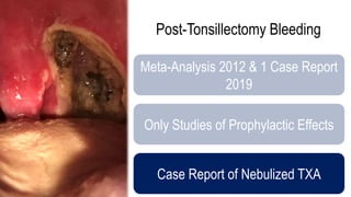 Post-Tonsillectomy Bleeding
Meta-Analysis 2012 & 1 Case Report
2019
Only Studies of Prophylactic Effects
Case Report of Nebulized TXA
 