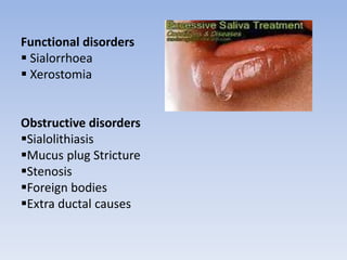 Functional disorders
 Sialorrhoea
 Xerostomia
Obstructive disorders
Sialolithiasis
Mucus plug Stricture
Stenosis
Foreign bodies
Extra ductal causes
 