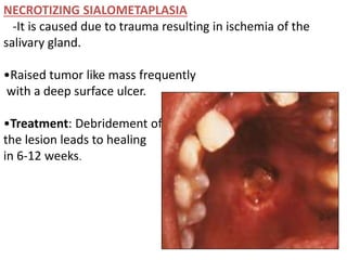 NECROTIZING SIALOMETAPLASIA
-It is caused due to trauma resulting in ischemia of the
salivary gland.
•Raised tumor like mass frequently
with a deep surface ulcer.
•Treatment: Debridement of
the lesion leads to healing
in 6-12 weeks.
 