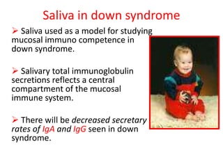 Saliva in down syndrome
 Saliva used as a model for studying
mucosal immuno competence in
down syndrome.
 Salivary total immunoglobulin
secretions reflects a central
compartment of the mucosal
immune system.
 There will be decreased secretary
rates of IgA and IgG seen in down
syndrome.
 
