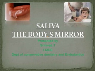 Presented by
Srinivas.T
I MDS
Dept of conservative dentistry and Endodontics
 