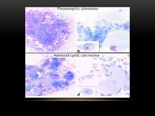 saliva and salivary glands by dr. Rao Adil.pdf