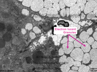 Electron lucent
Granules
 