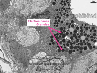 Electron dense
Granules
 